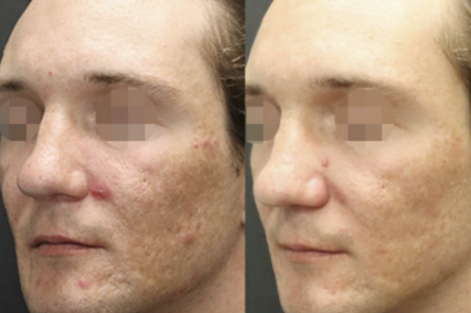 Patient result