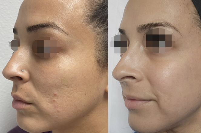Patient result
