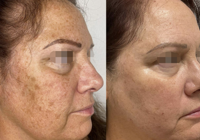 Patient result