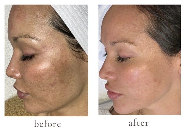 Patient result