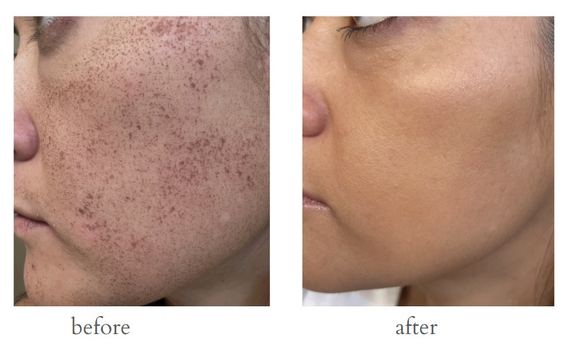 Patient result